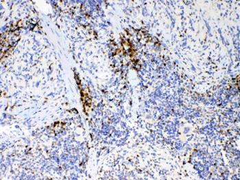 IL17/Il17a Rabbit Polyclonal Antibody