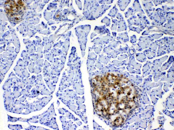 IL17/Il17a Rabbit Polyclonal Antibody