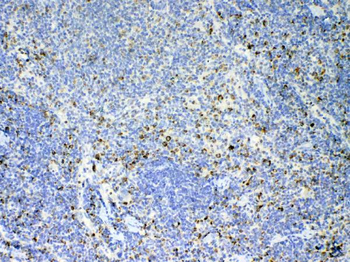 IL17/Il17a Rabbit Polyclonal Antibody