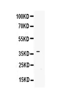 IGFBP3 Rabbit Polyclonal Antibody