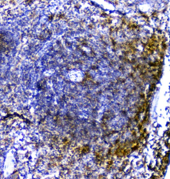 TRAIL/TNFSF10 Rabbit Polyclonal Antibody