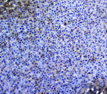TRAIL/TNFSF10 Rabbit Polyclonal Antibody