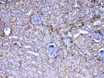 Galectin 1/Lgals1 Rabbit Polyclonal Antibody