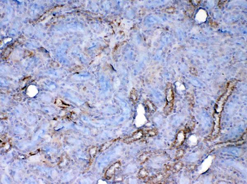 Galectin 1/Lgals1 Rabbit Polyclonal Antibody