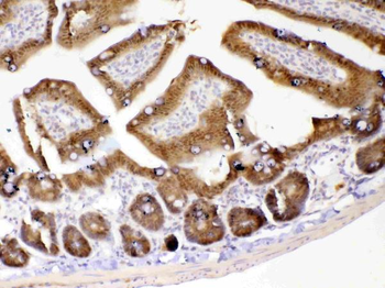 GALE Rabbit Polyclonal Antibody