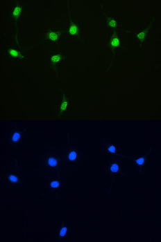 XRCC1 Rabbit Polyclonal Antibody