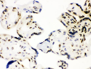 XRCC1 Rabbit Polyclonal Antibody