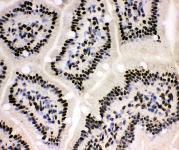 XRCC1 Rabbit Polyclonal Antibody