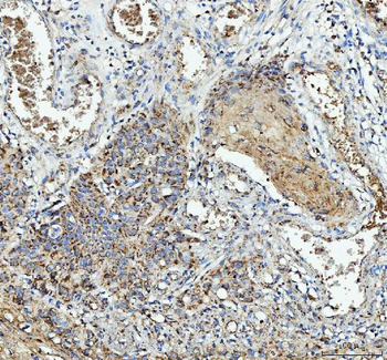 IL1RA/IL1RN Rabbit Polyclonal Antibody