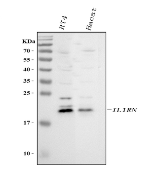 IL1RA/IL1RN Rabbit Polyclonal Antibody