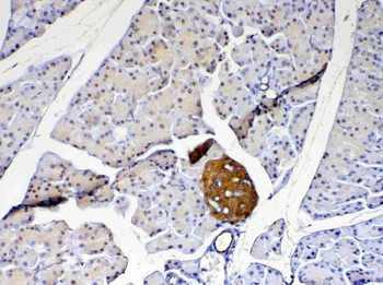 PARK7/DJ1 Rabbit Polyclonal Antibody