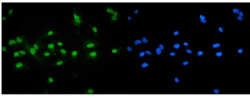Bile Acid Receptor NR1H4 Rabbit Polyclonal Antibody