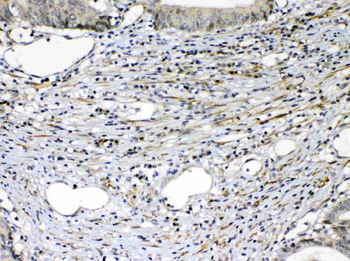 VEGF Receptor 2/KDR Rabbit Polyclonal Antibody