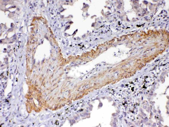 VEGF Receptor 2/KDR Rabbit Polyclonal Antibody