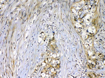VEGF Receptor 2/KDR Rabbit Polyclonal Antibody