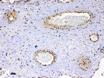 VEGF Receptor 2/KDR Rabbit Polyclonal Antibody