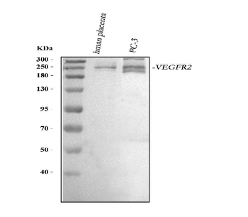 VEGF Receptor 2/KDR Rabbit Polyclonal Antibody