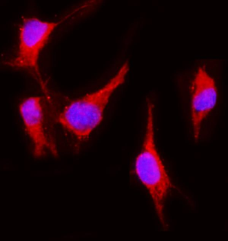 VEGF Receptor 2/Kdr Rabbit Polyclonal Antibody