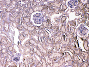 VEGF Receptor 2/Kdr Rabbit Polyclonal Antibody