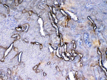 VEGF Receptor 2/Kdr Rabbit Polyclonal Antibody
