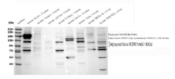 VEGF Receptor 2/Kdr Rabbit Polyclonal Antibody