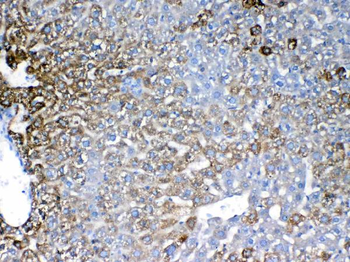 IGFBP1 Rabbit Polyclonal Antibody
