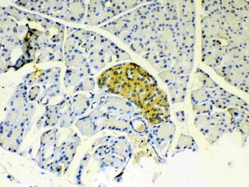 IGFBP1 Rabbit Polyclonal Antibody