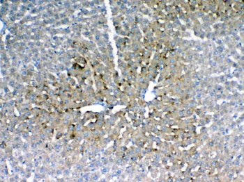 IGFBP1 Rabbit Polyclonal Antibody