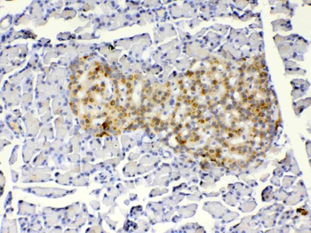 IGFBP1 Rabbit Polyclonal Antibody