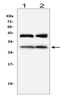IGFBP1 Rabbit Polyclonal Antibody