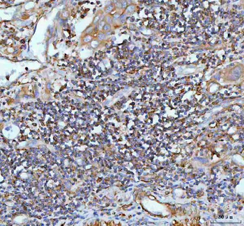 IL-22/IL22/IL Rabbit Polyclonal Antibody