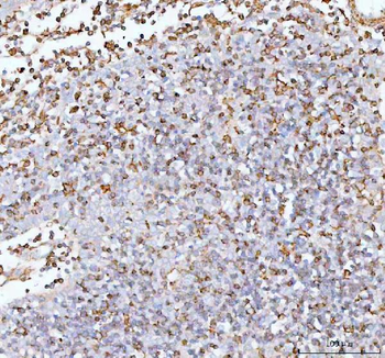 IL-22/IL22/IL Rabbit Polyclonal Antibody