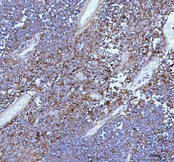 IL-22/IL22/IL Rabbit Polyclonal Antibody