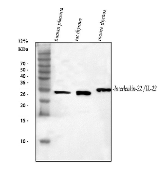 IL-22/IL22/IL Rabbit Polyclonal Antibody
