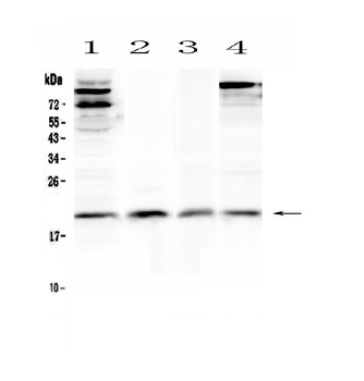 IL22 Rabbit Polyclonal Antibody