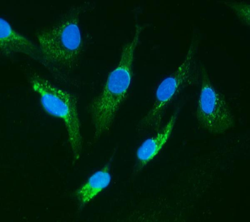 IRAK/IRAK1 Rabbit Polyclonal Antibody