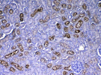 RBP4 Rabbit Polyclonal Antibody