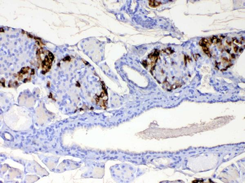 RBP4 Rabbit Polyclonal Antibody