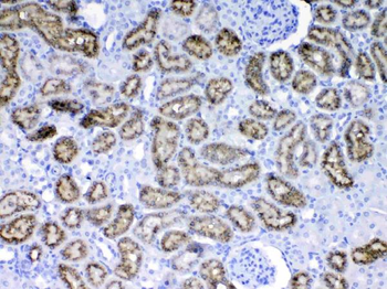 RBP4 Rabbit Polyclonal Antibody