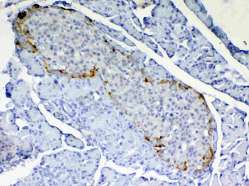 RBP4 Rabbit Polyclonal Antibody