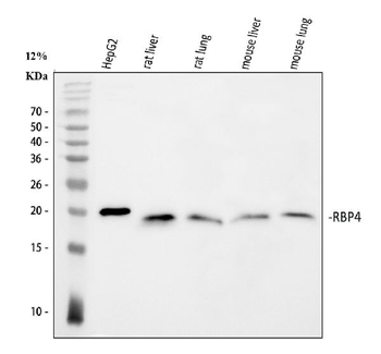 RBP4 Rabbit Polyclonal Antibody
