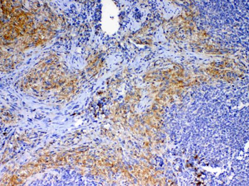 CD40L/Cd40lg Rabbit Polyclonal Antibody