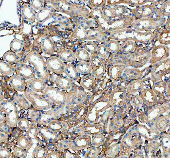 Factor D/CFD Rabbit Polyclonal Antibody