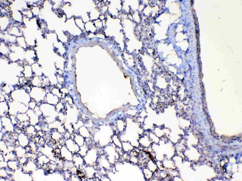 Factor D/Cfd Rabbit Polyclonal Antibody