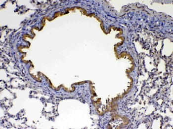 Factor D/Cfd Rabbit Polyclonal Antibody