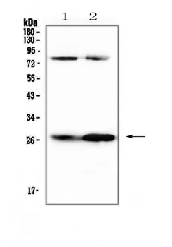 Factor D/Cfd Rabbit Polyclonal Antibody