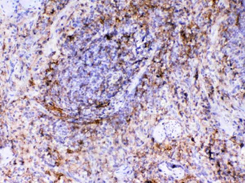 VCAM1 Rabbit Polyclonal Antibody