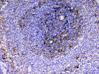 VCAM1 Rabbit Polyclonal Antibody