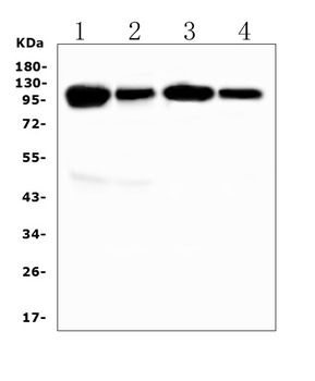 VCAM1 Rabbit Polyclonal Antibody