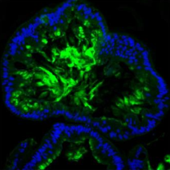 MUC2 Rabbit Polyclonal Antibody